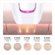 IPL Epilátor Laser Hair Removal – zariadenie na epiláciu a omladenie pleti ADM7012