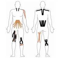 Kinesio Tejp 5 m × 5 cm - Žltá - KINESIOLÓGIA TAPE